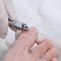 Коррекция ногтя титановой нитью